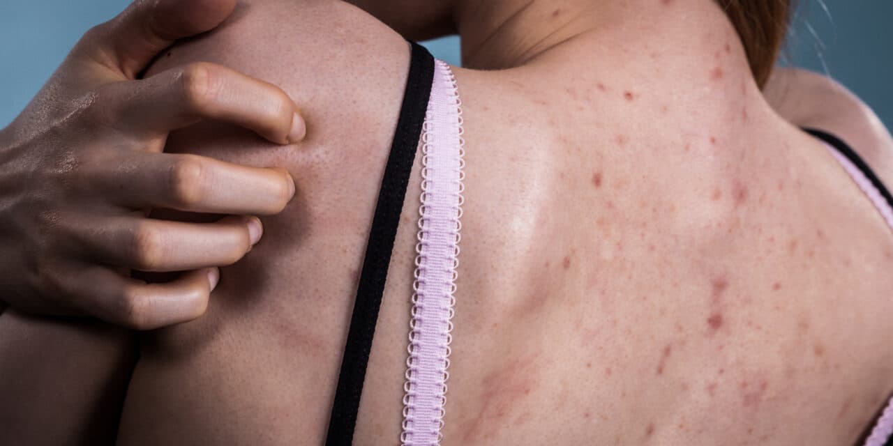 Lebensrettende Hautkrebsvorsorge: Erfahrene Dermatologen im Einsatz