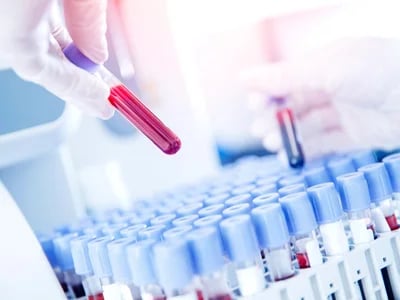 LIS: Unterschiede zwischen LIS und anderen Laborsystemen